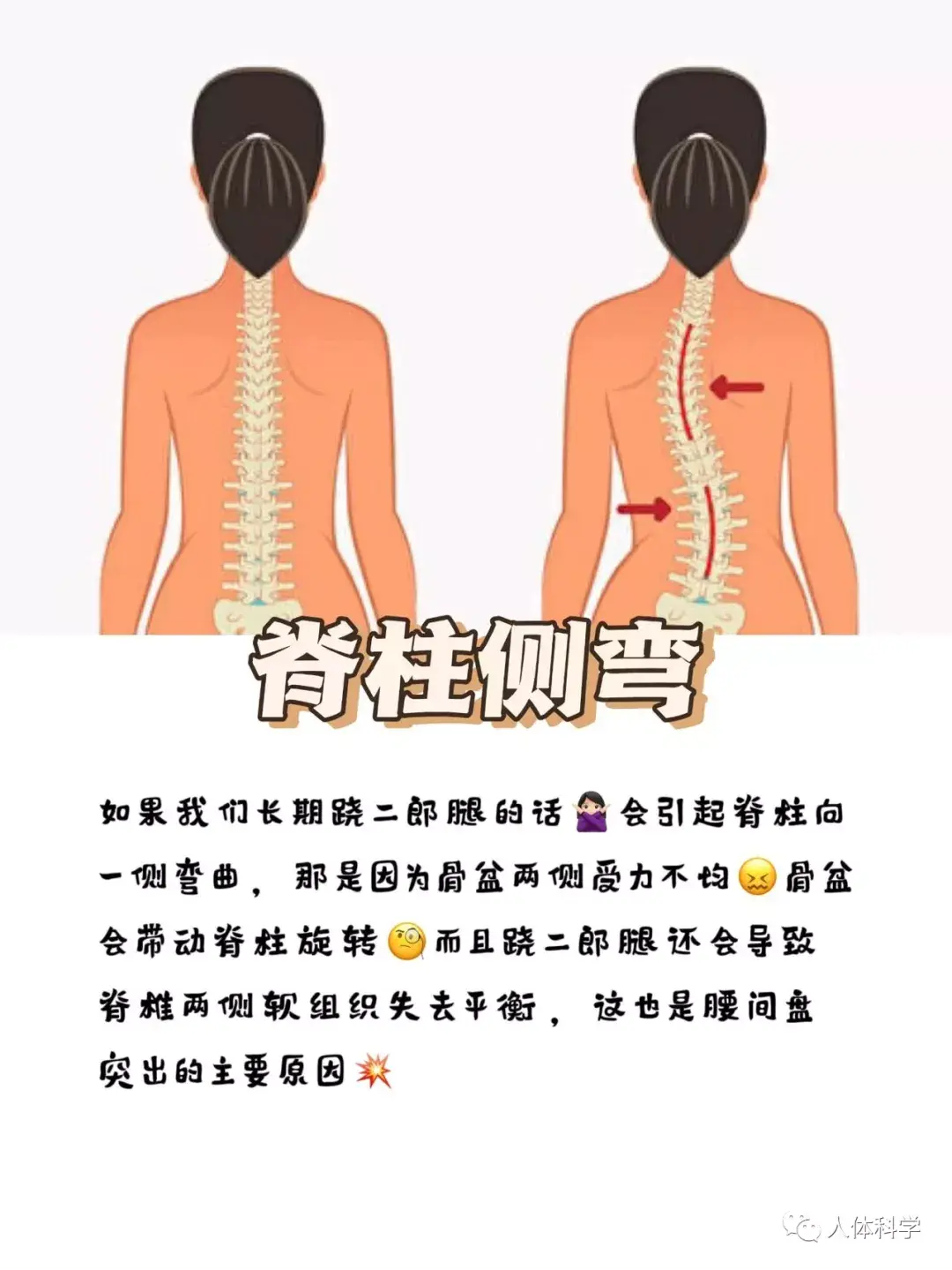 【错误姿态】长期跷二郎腿的人到底会怎么样!