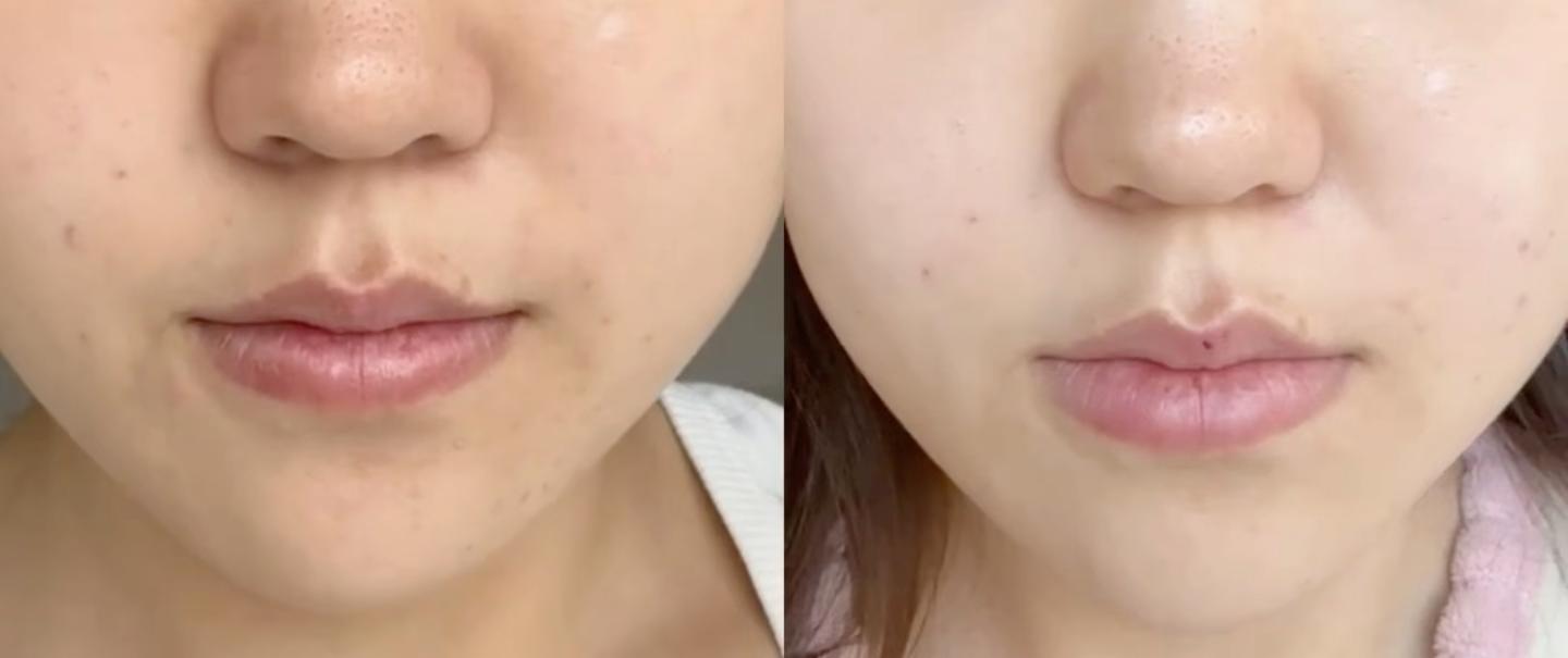 热门vc产品应该怎么选？有什么性价比高又好用的推荐吗？肤色暗沉、蜡黄没气色、斑点痘印的看过来- 知乎