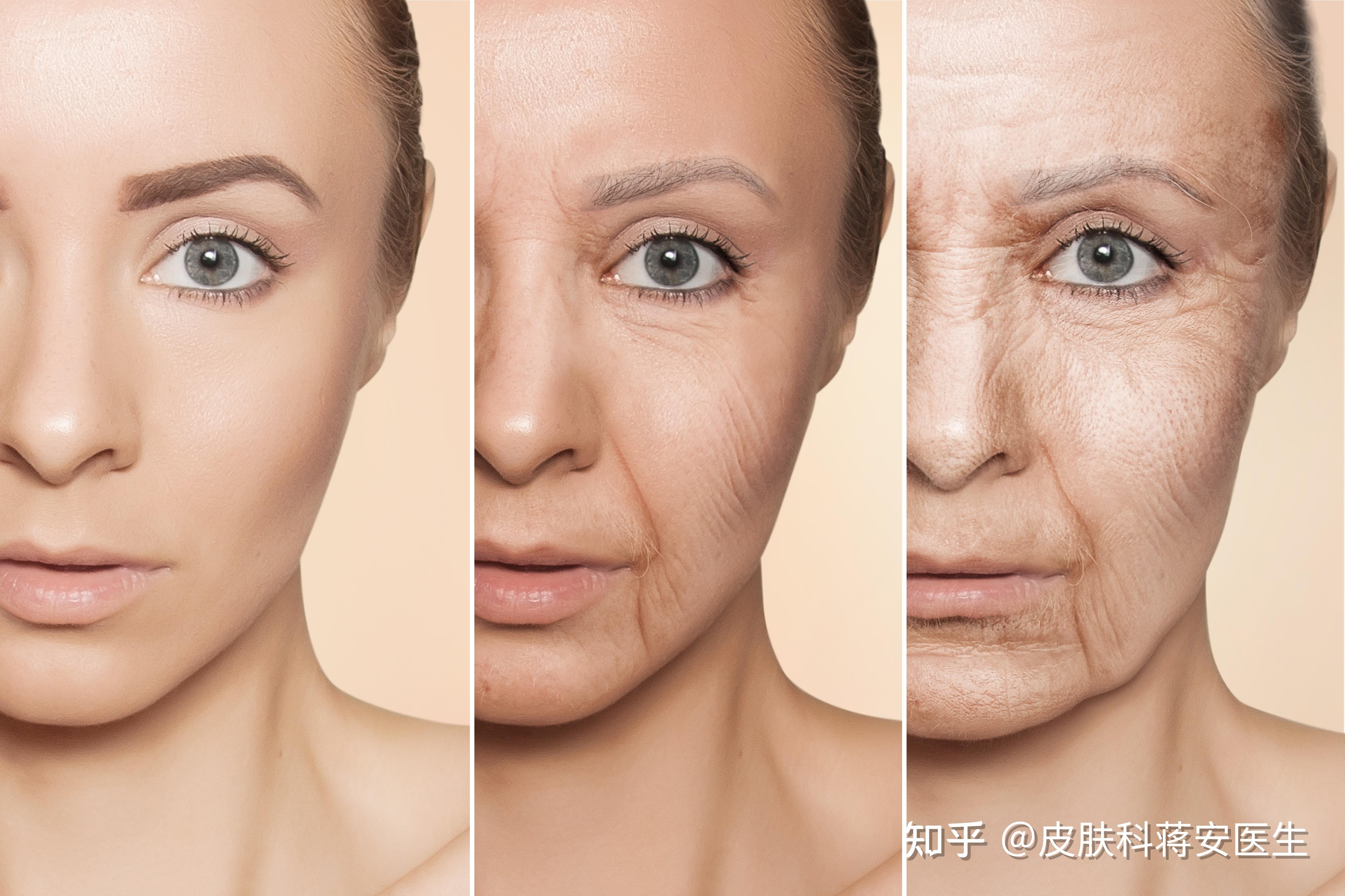 了解清楚皮肤衰老的表现后就知道怎么去合理抗衰 - 知乎