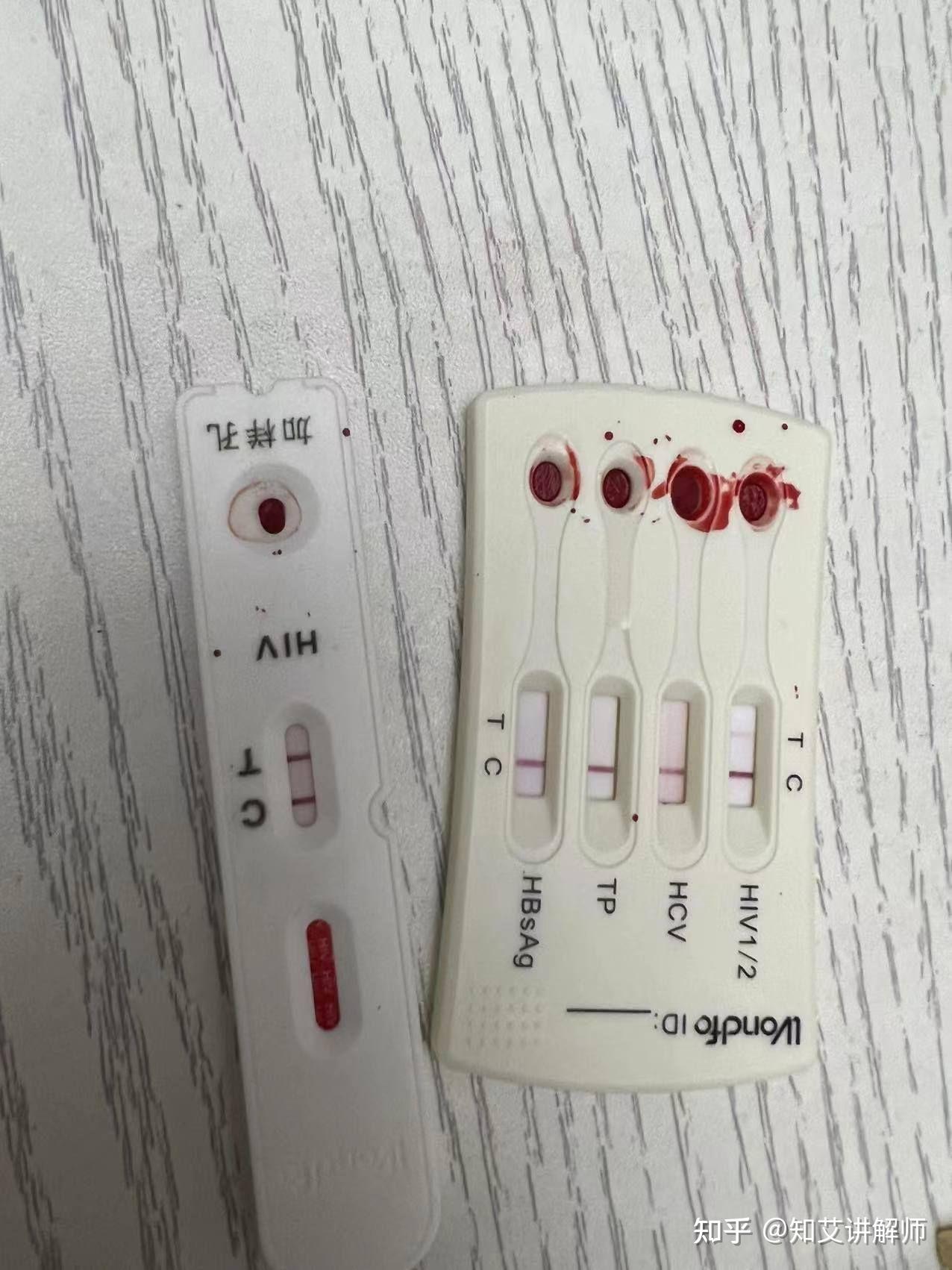 各位大神,这是hiv阴性结果吧? - 知乎