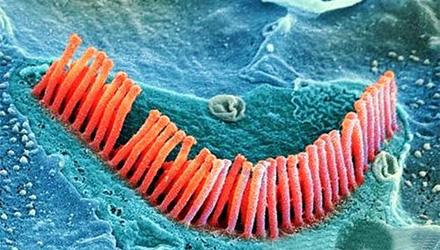 对重度听力损失患者的验配建议
