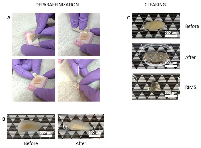 Tissue Clearing Protocol 知乎