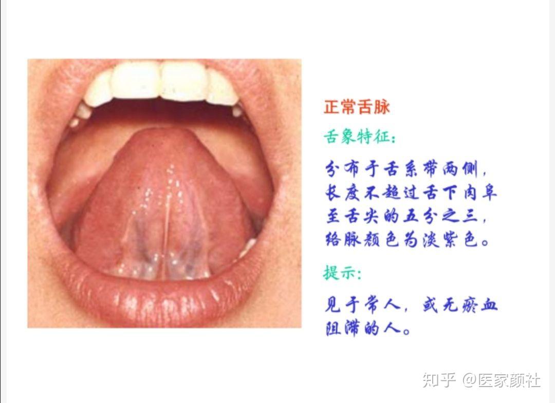 舌脉正常图片大全图片