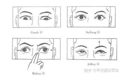 吸烟还和甲状腺疾病有关你知道吗