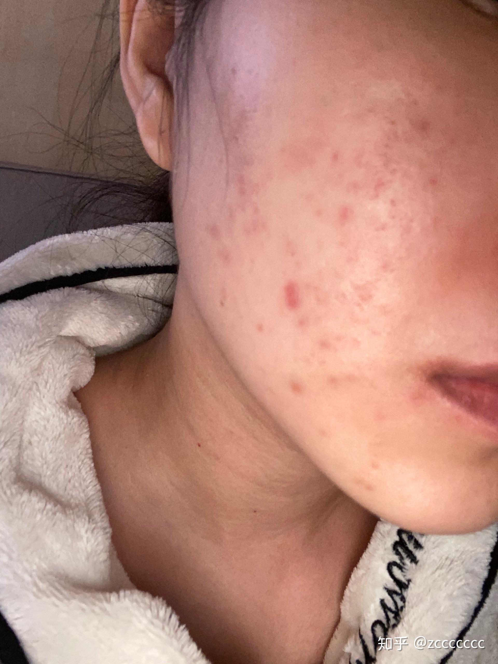 16 更感觉皮肤变得很滑很亮反光那种,尴尬的是眼周没有涂就眼周不反光