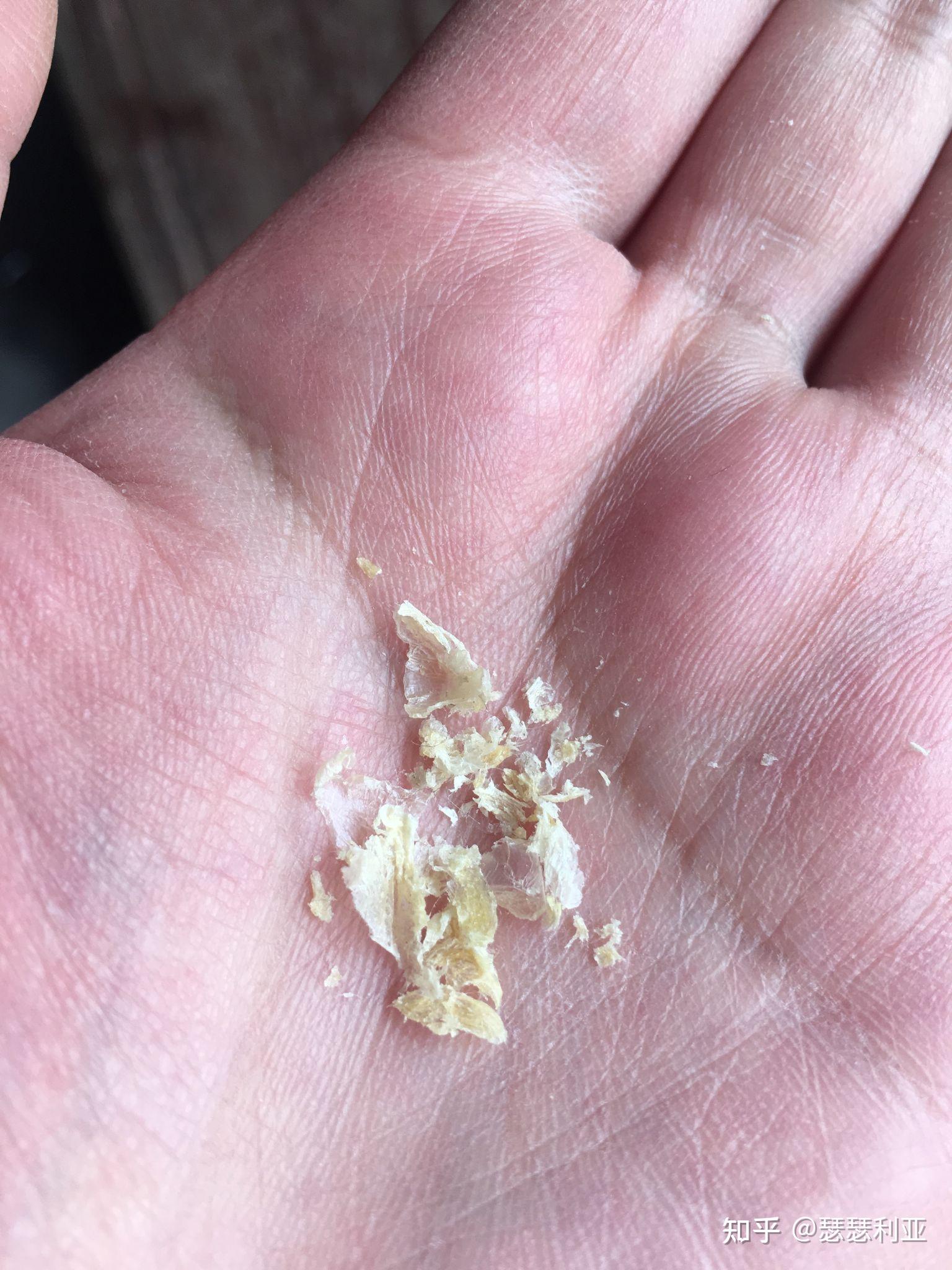 掏出一块超大耳屎,是种什么体验? - 知乎