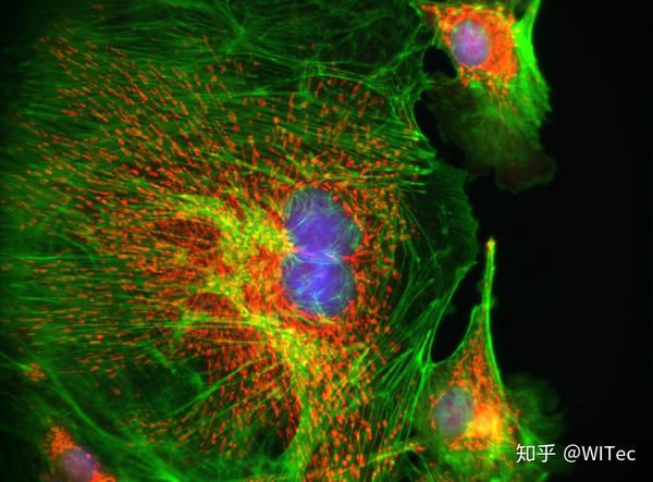 witec拉曼宽场荧光成像荣获microscopytodaymicrographaward