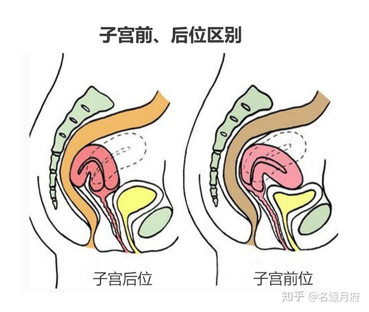 子宮前位子宮後位哪一種更容易懷孕