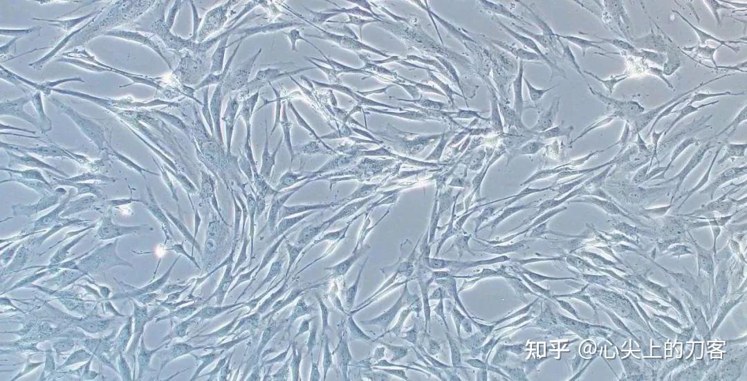 间充质干细胞治疗适应症有哪些 - 知乎