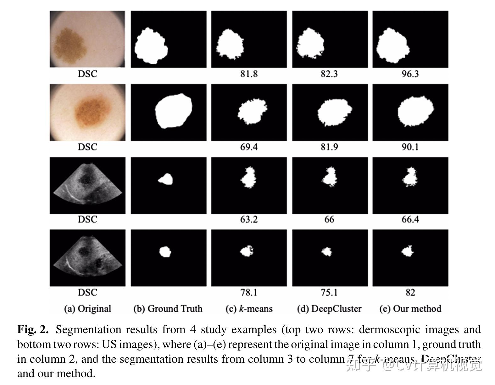 A spatial guided self supervised clustering network for medical image