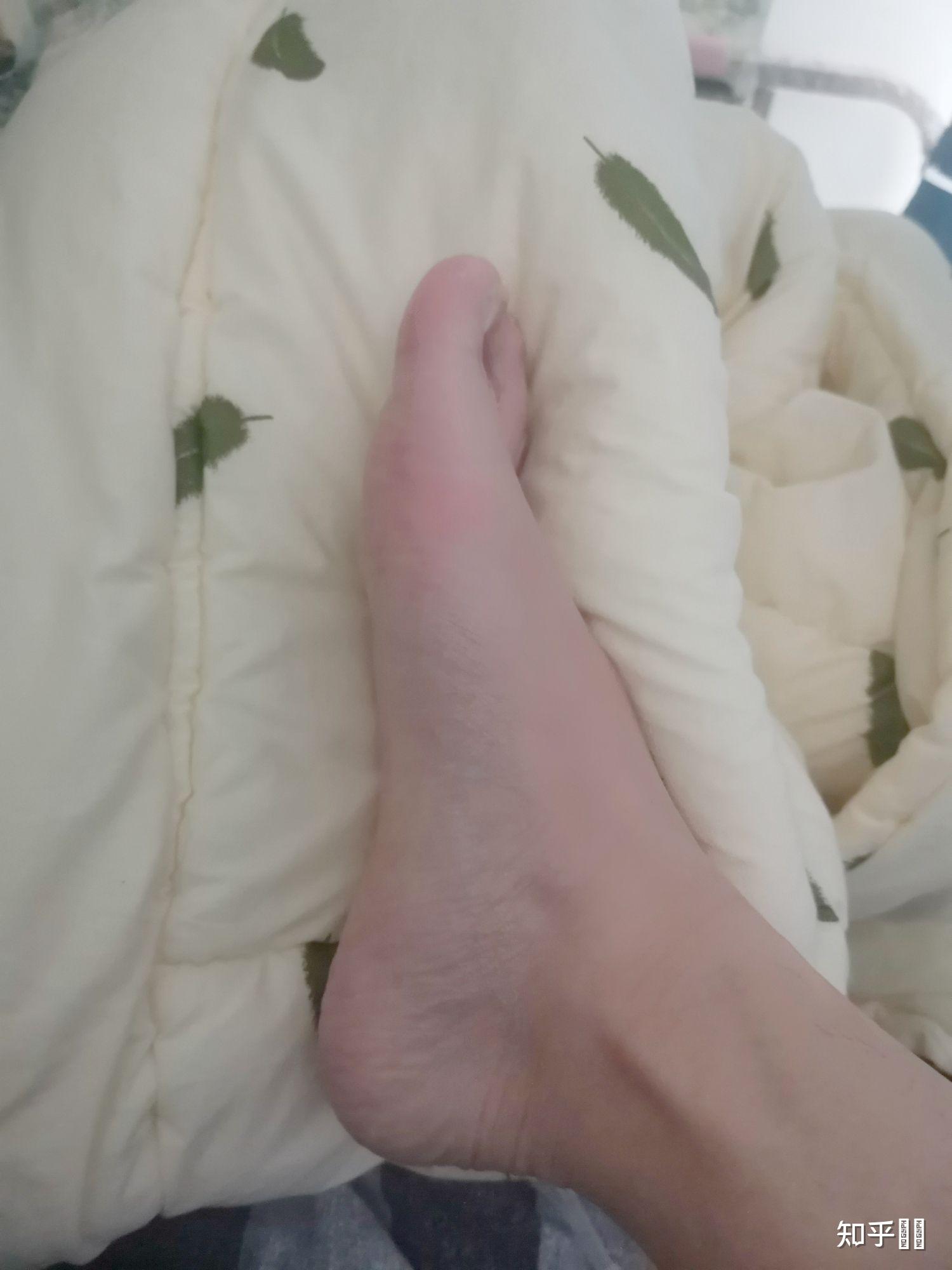 男孩脚底照片有什么问题吗