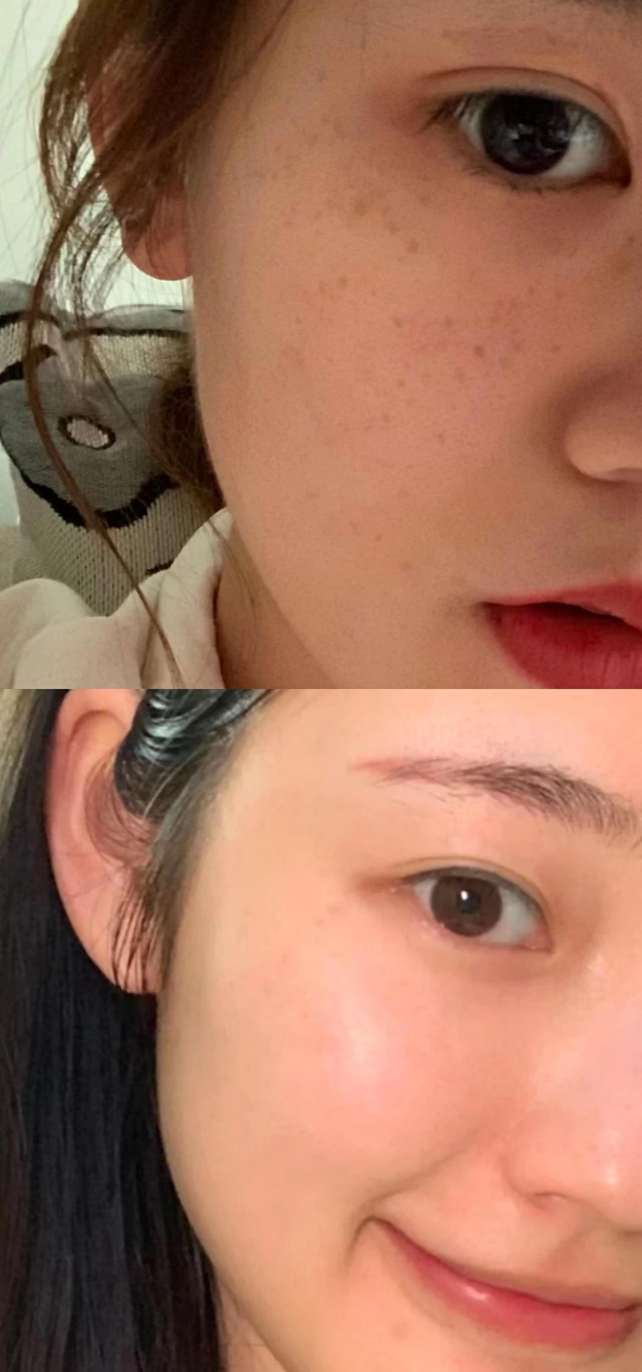 有哪些功效特别「猛」的美白淡斑产品推荐?