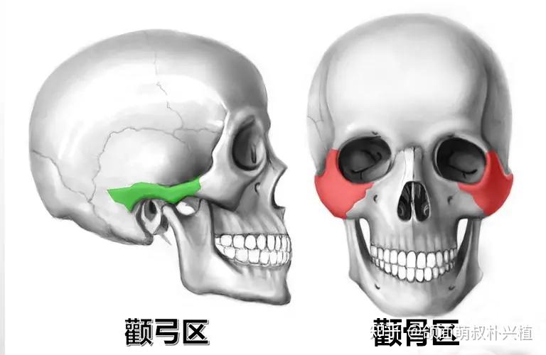 关于颧骨高颧弓外扩颧骨手术的一些真相附注意事项