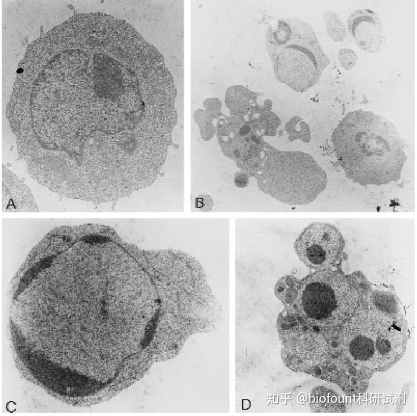 细胞凋亡检测（实验简介,实验目的,实验原理,所需试剂,方法步骤） - 知乎