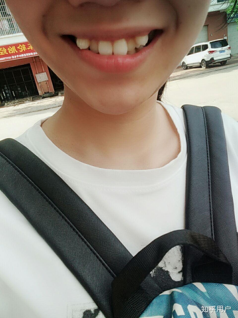 有虎牙是一种怎样的体验