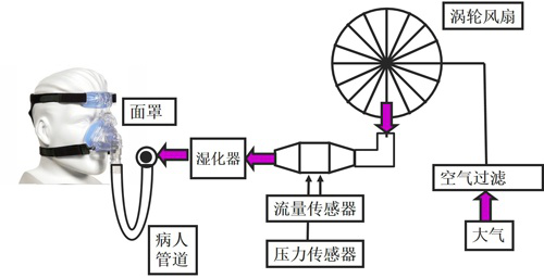 消除气道阻塞。呼吸帮：独家为您解读家用呼吸机工作原理​zhuanlan.zhihu.com