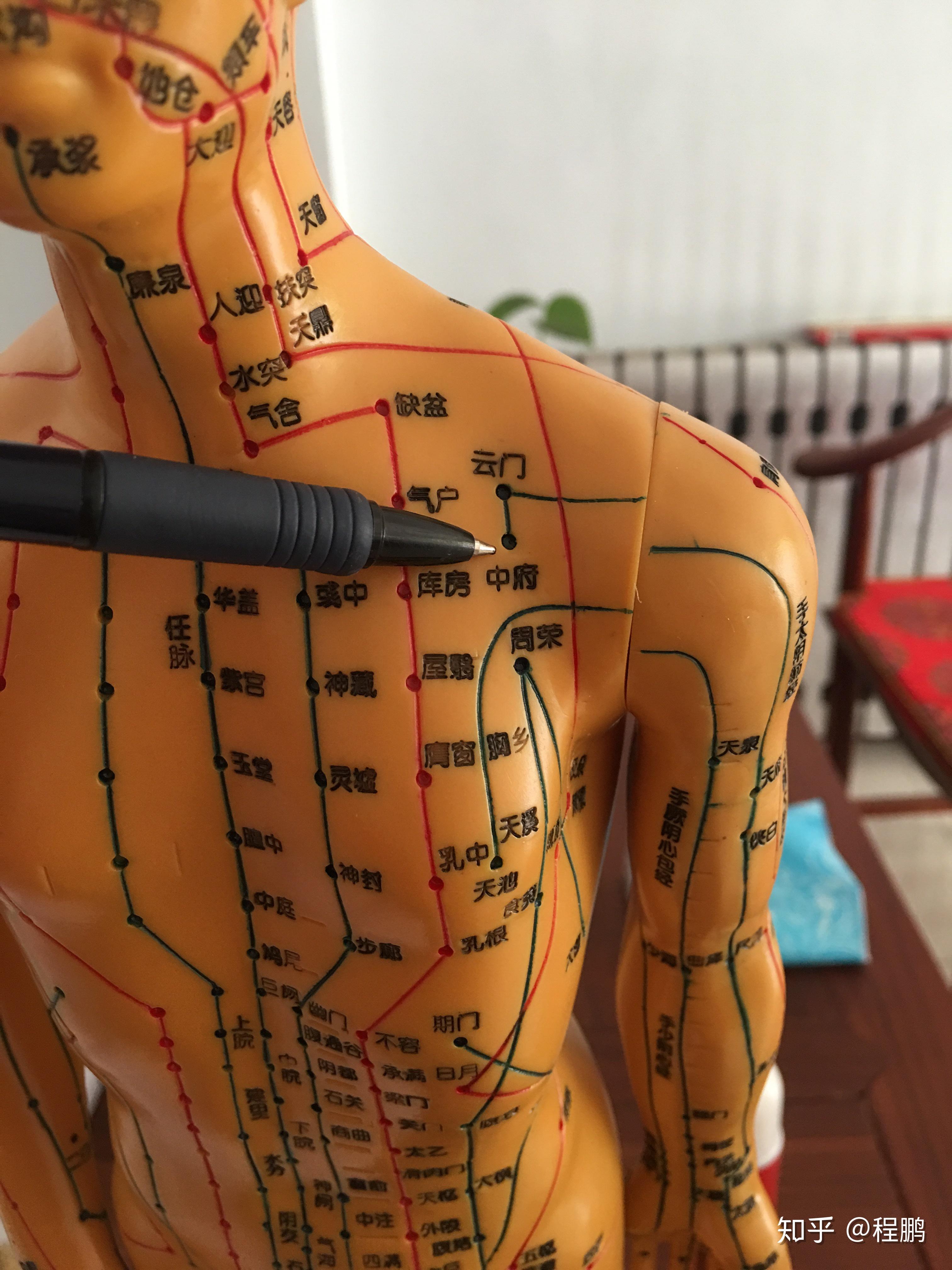 拔罐调理病症之~肩周炎 - 知乎