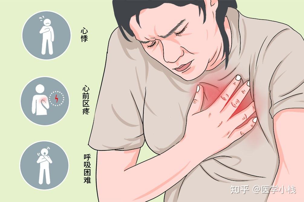 心脏神经官能症有什么确诊的技巧吗