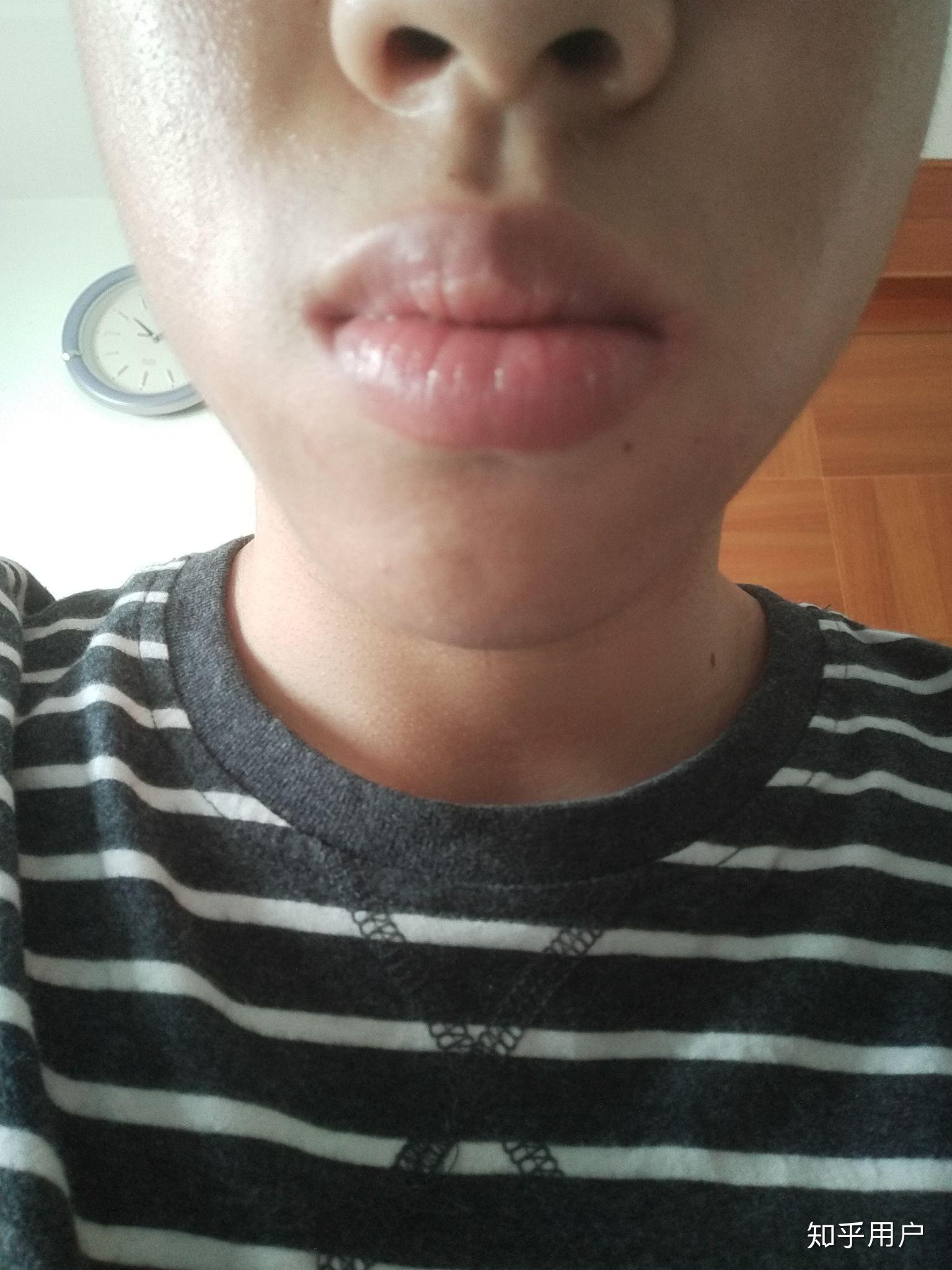 男生嘴唇太厚怎么办? - 知乎
