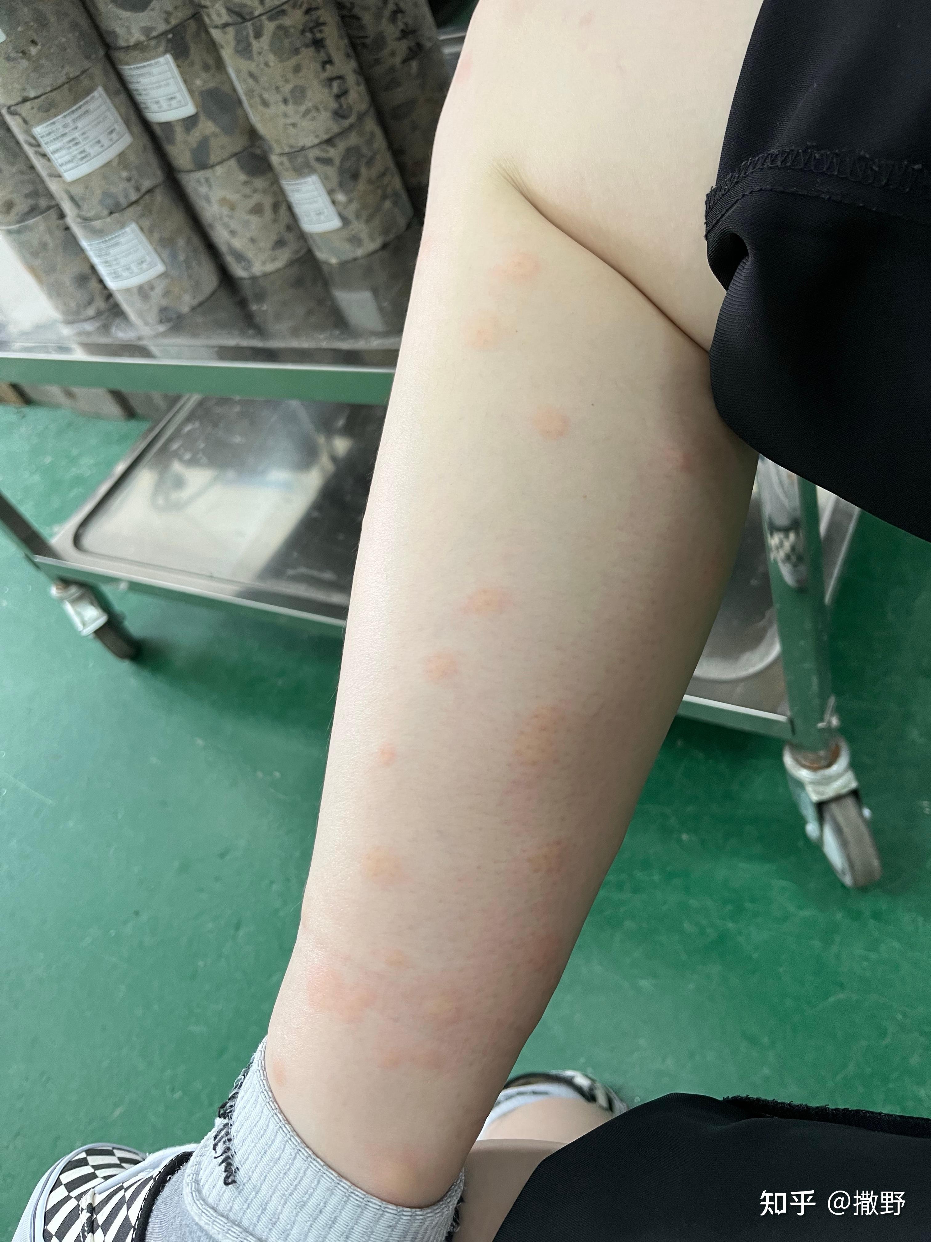 蠓,一种很难发现的小黑蚊.被折磨了好多年了