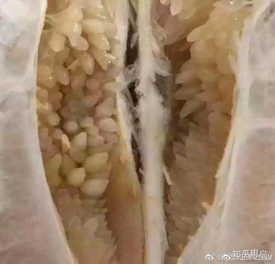 活人身上会不会长蛆