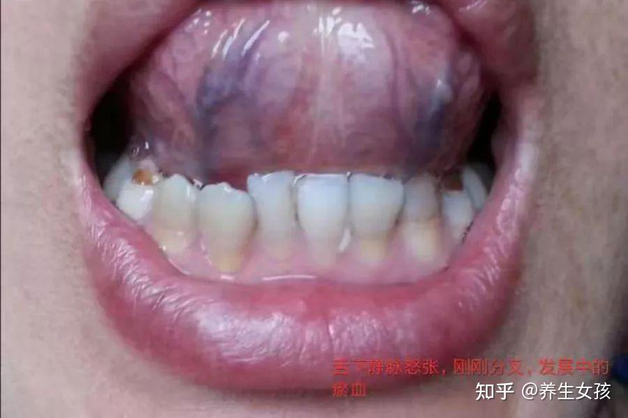 气血瘀堵有哪些症状？ - 知乎
