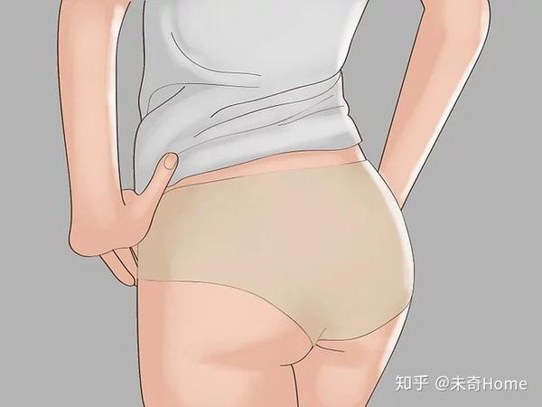 女生校裤常会映出内裤轮廓,怎样避免?