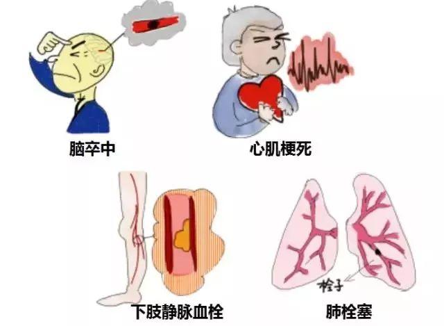 說話言語不清,到醫院一檢查,是