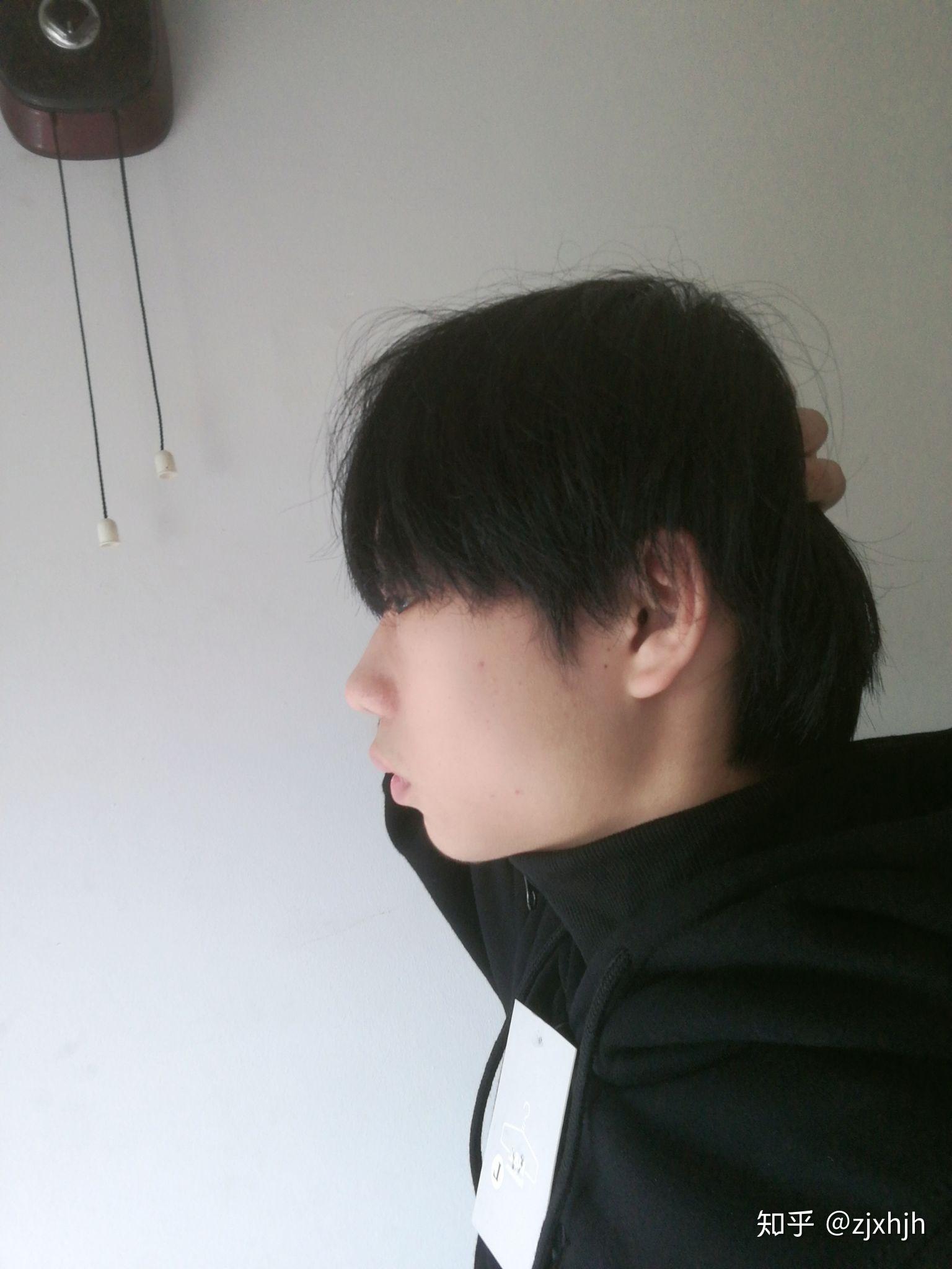 头型小时候被家长故意睡成扁头怎么办