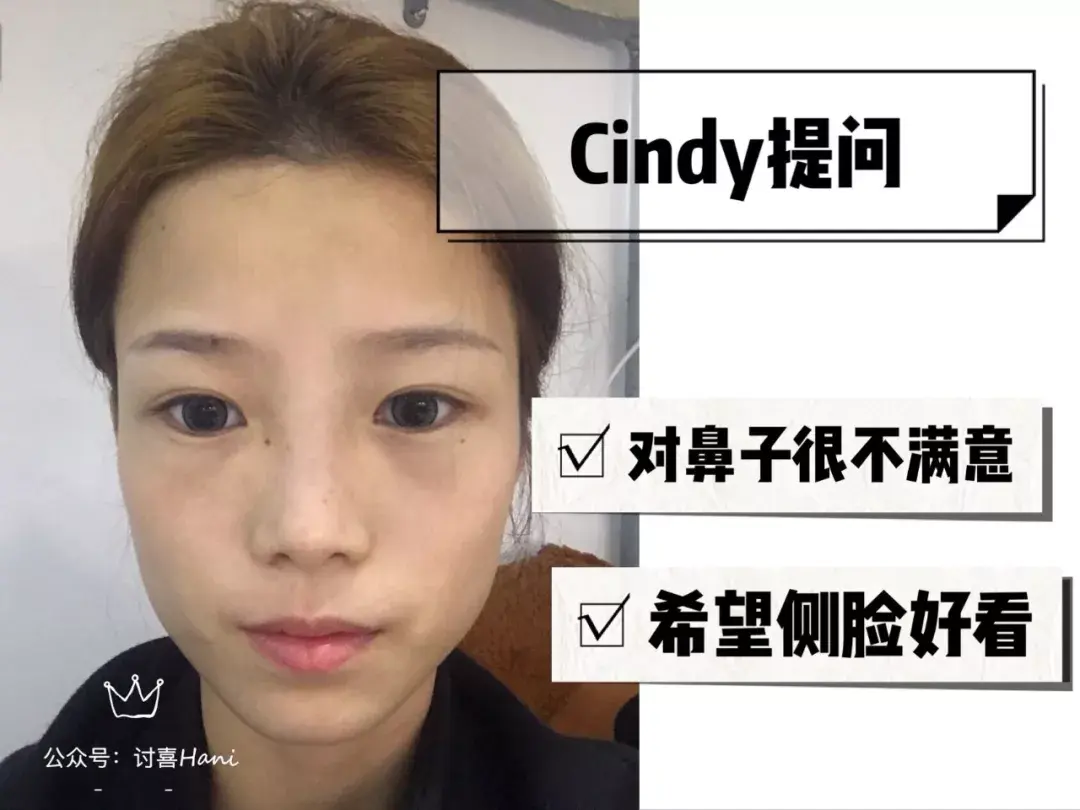 讨喜hani扁平脸该如何改善凄苦相