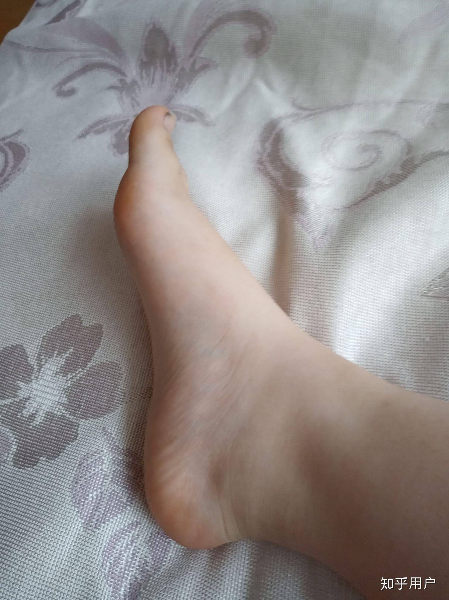 女生脚丑是种什么样的体验