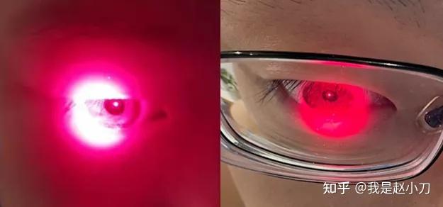 文献解读红光治疗在近视防控中的作用