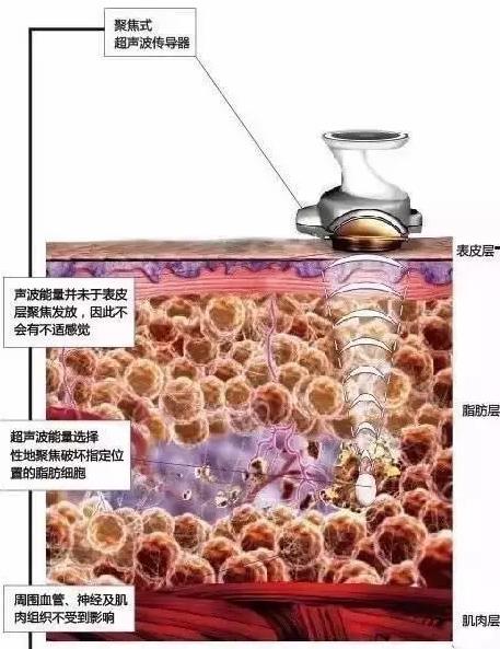 优立塑热立塑傻傻分不清看完这三点你就懂了