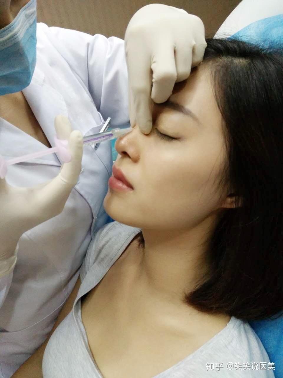 你不知道的微整形注射技巧三