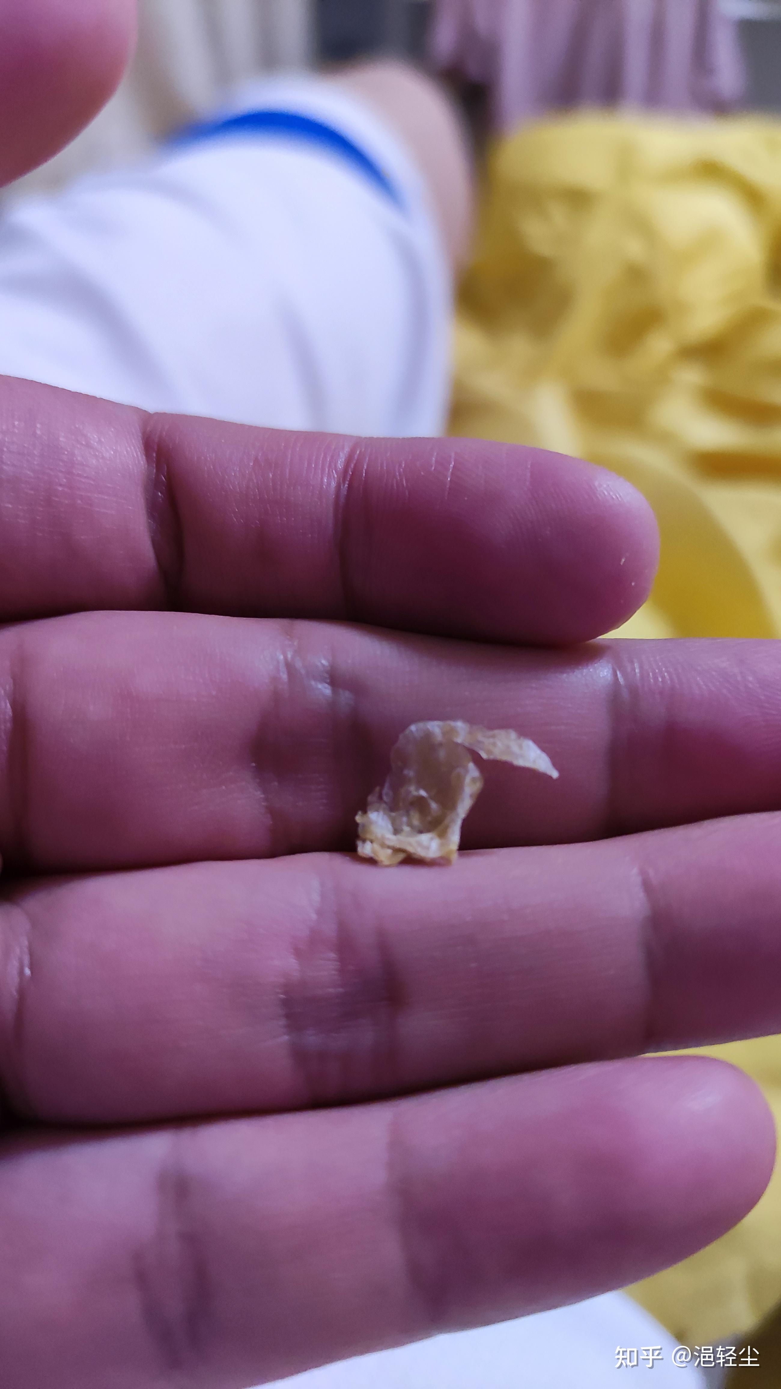 掏出一块超大耳屎是种什么体验