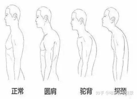 康复指导 5个步骤自测是否 圆肩 4个锻炼手把手教你如何纠正 知乎