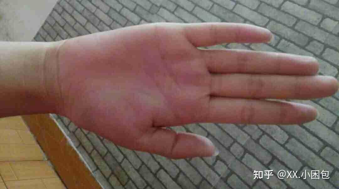 被老师用戒尺打手心是怎样一种体验