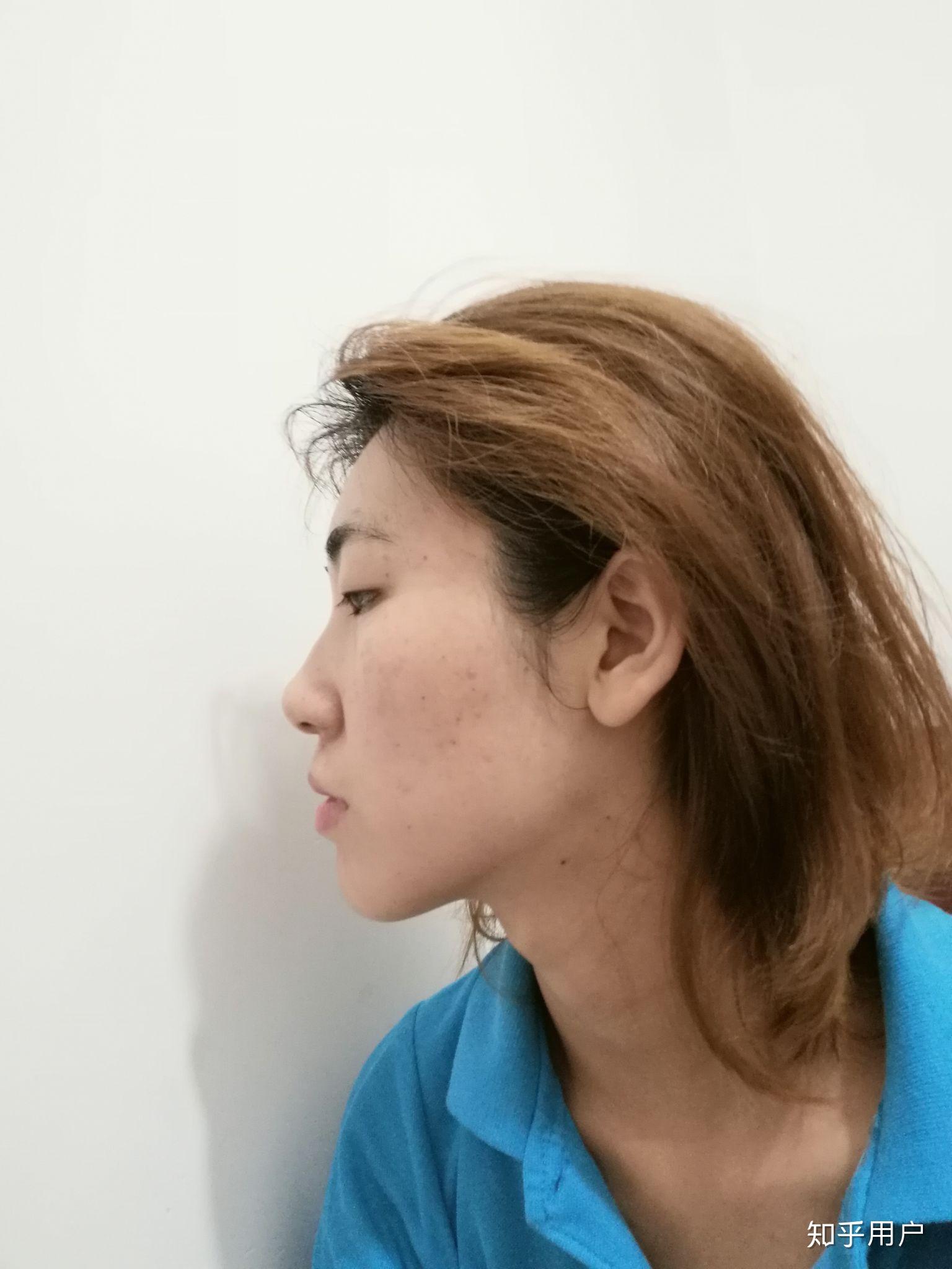 女生好看的下颌线是怎样的