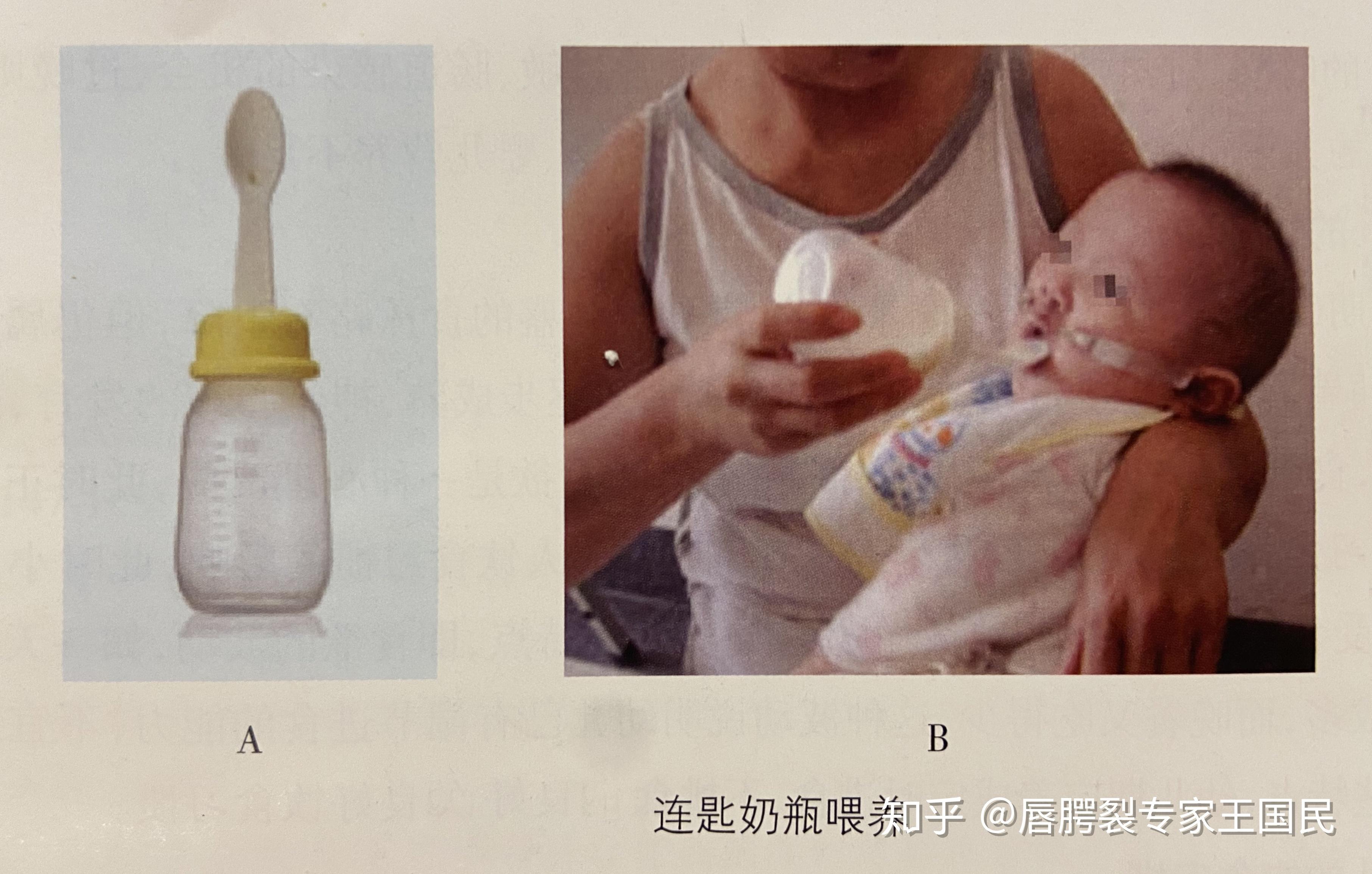 正常婴儿嘴唇图片大全（新生儿自带5种条件反射）-幼儿百科-魔术铺