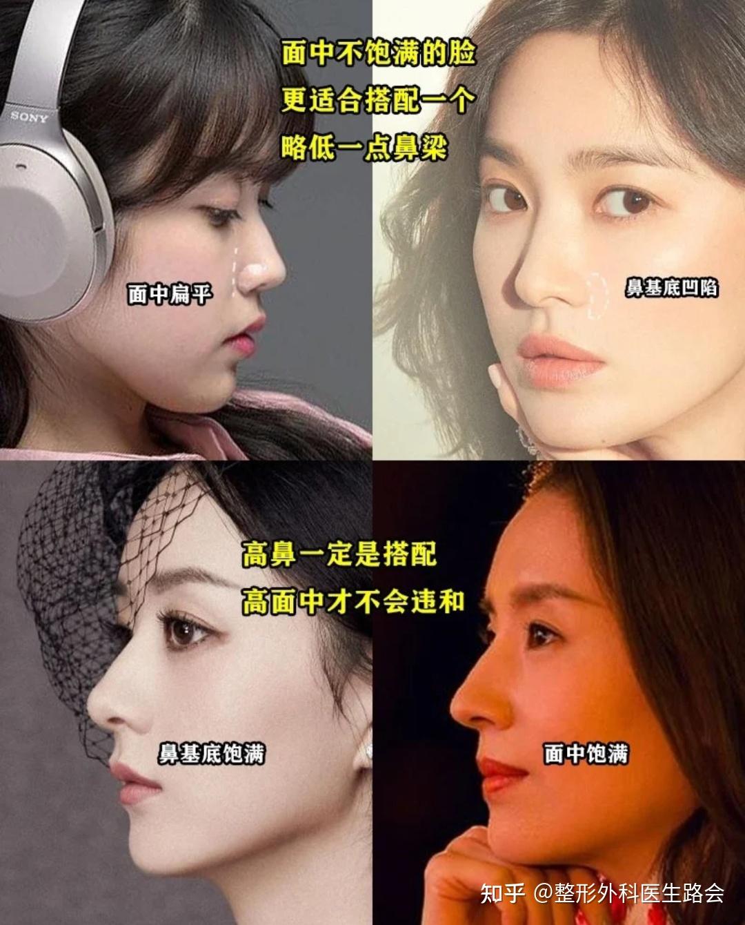 直鼻翘鼻微驼峰好看的鼻子怎么选