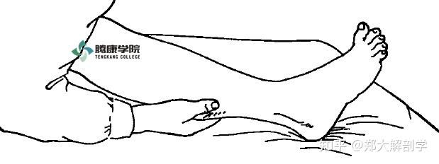 chaddock征用竹签沿足背外侧缘,从后向前至小趾根部,然后转向内侧到大