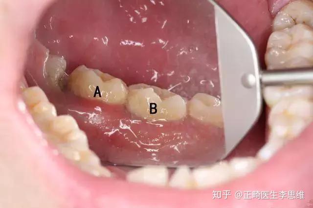 v2-13ab6d69a4c8eb2d3c5386a1de0f84a0_r.jpg