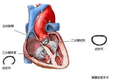 心脏腱索图片图片