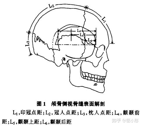 头皮针结构图图片