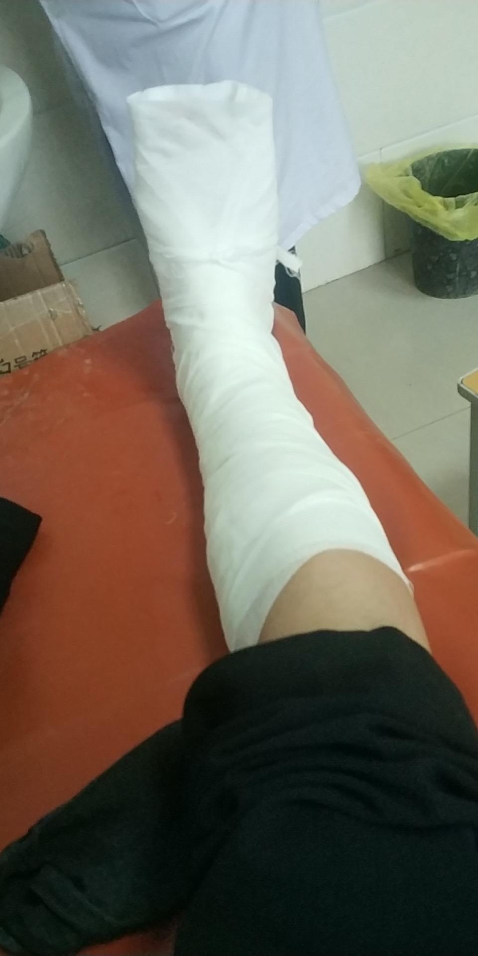 大拇脚趾头骨折 如何快速恢复?