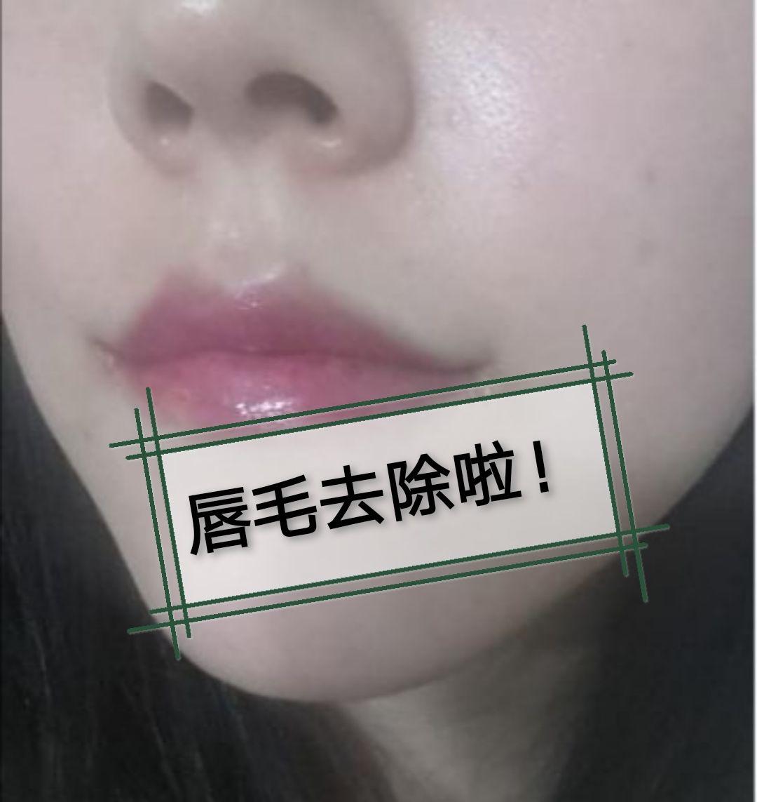 女生有唇毛小胡子,3个方法终极去除!