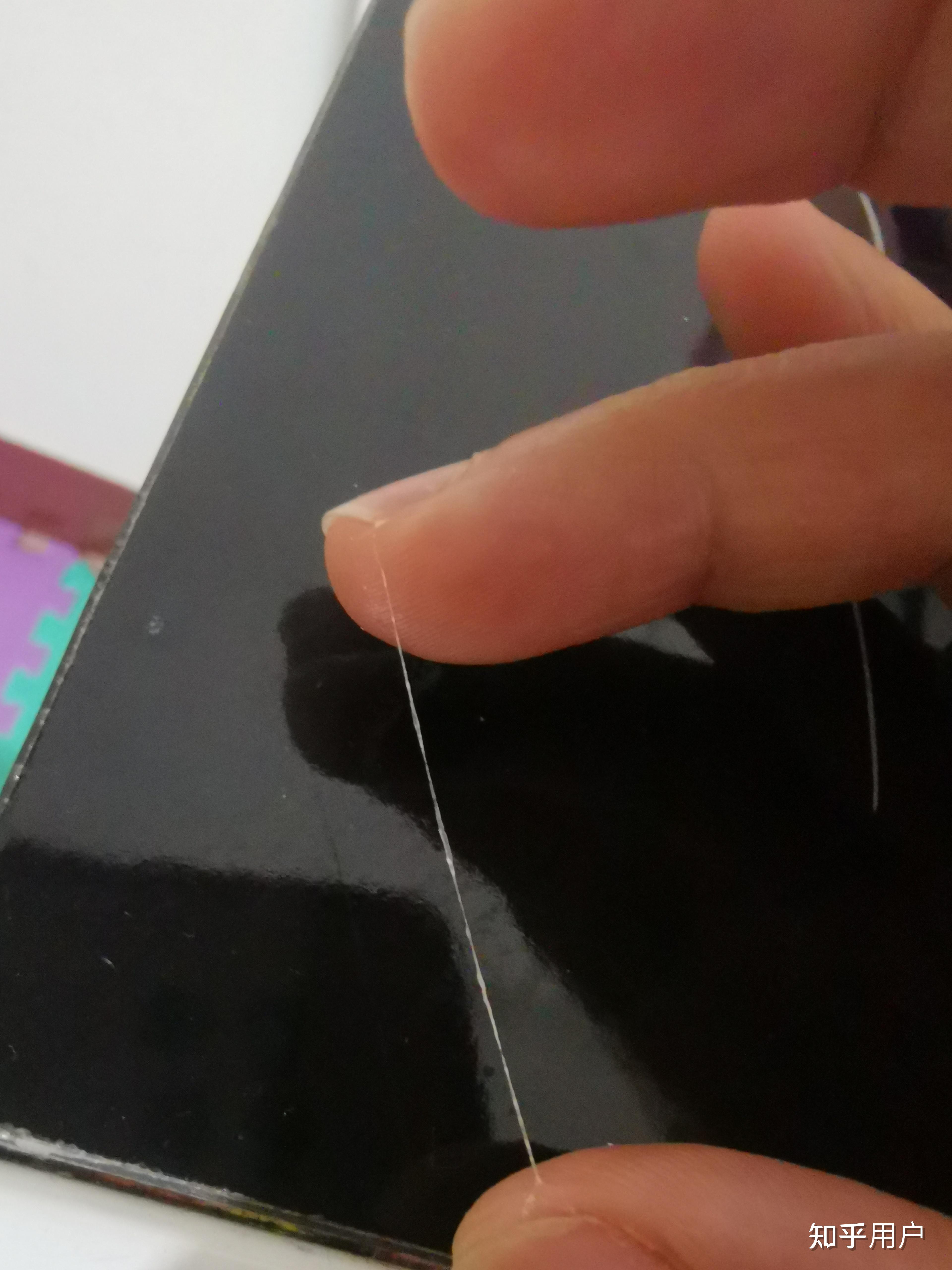 想问一下大家有没有眼睛里总是能抠出白色丝状物,有点黏,很长一根,洗