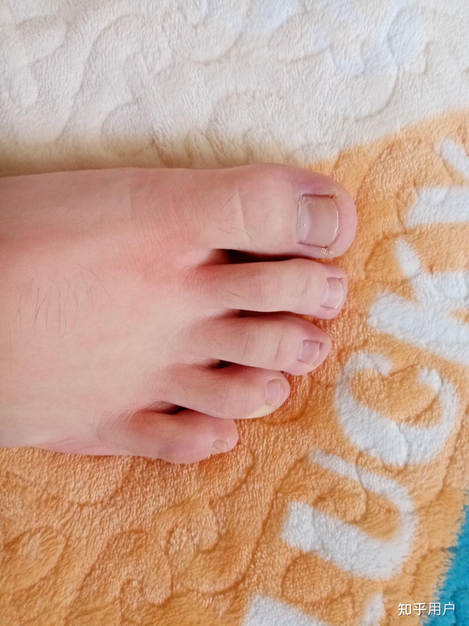 男孩子有一双好看的脚是一种什么样的体验