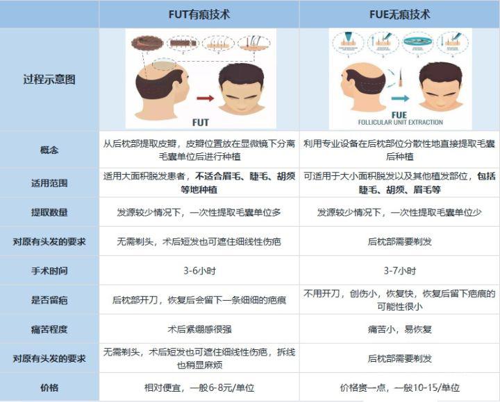 杭州植发手术fue和fut技术的优缺点有哪些哪种植发技术最好安不安全