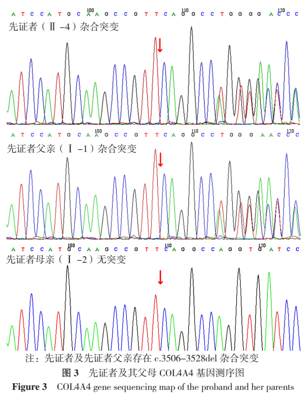 DNA测序峰图图片